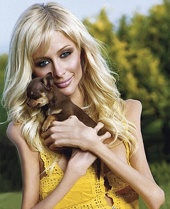 Paris Hilton Anorexia
