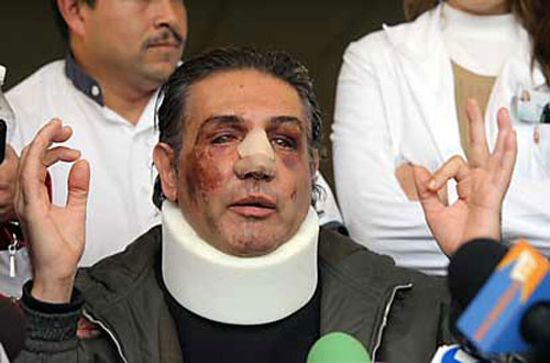 Fabian Lavalle sale del hospital