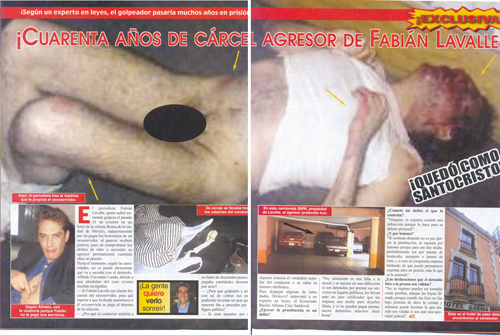 Fabiruchis desnudo