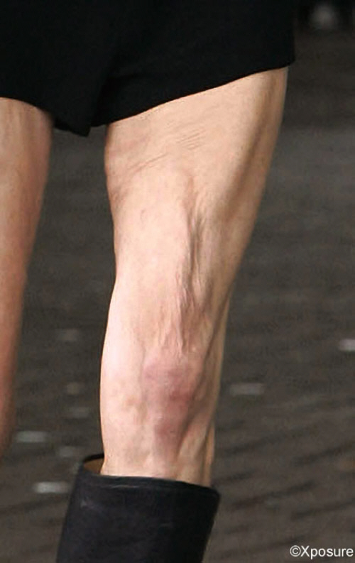 Kate Moss knees Kate Moss knees